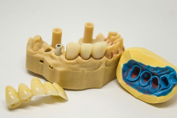 denture repair